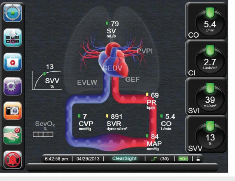 وبینار پایش های مهم در بیماران بخش های مراقبت ویژه (Monitoring in ICU